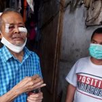 Dianiaya Menantu Hingga Babak Belur, Pria Paruh Baya di Cengkareng Lapor Polisi