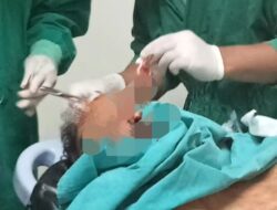 Korban Penganiayaan Luka 19 Jahitan di Kepala, Polsek Cengkareng Lepas Pelaku Alasan Kooperatif