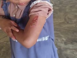 Anak Dianiaya Ibu Tiri, Bapak Malah Pilih Tak Lapor Polisi