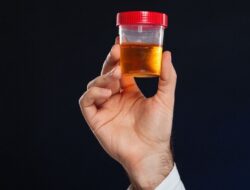 Imbas Kasus Narkoba Eks Kapolres Bima, Pemeriksaan Urine Digelar di Polres Jaksel